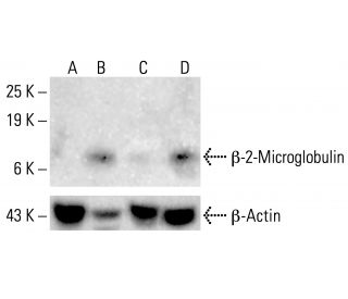 mi様ブラック2 Gemin2 Antibody (A-9) | SCBT - Santa Cruz Biotechnology