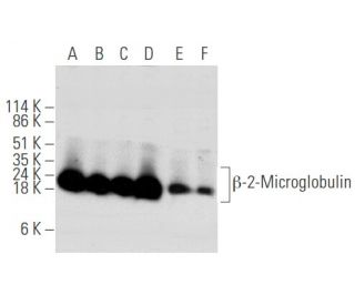 western blotting image from recommended β-2-Microglobulin (G-10) monoclonal antibody replacement. Image 354765