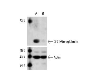 &beta;-2-Microglobulin siRNA (h): sc-29592. Western blot analysis of b-2-Microglobulin expression in non-transfected contr 