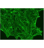 beta Actin Antibody (AC-15) | SCBT - Santa Cruz Biotechnology