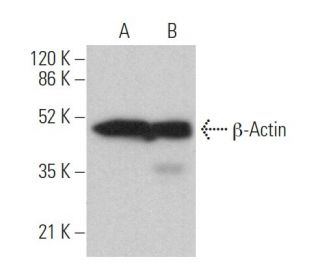 beta Actin Anticorpo C4 SCBT Santa Cruz Biotechnology