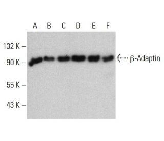 &beta;-Adaptin Antibody (100/1) - Western Blotting - Image 381003 