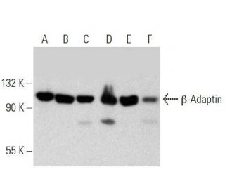 &beta;-Adaptin Antibody (A-5) - Western Blotting - Image 358647 