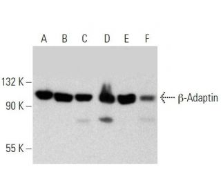 western blotting image from recommended &beta;-Adaptin (A-5) monoclonal antibody replacement. Image 358647