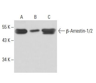 beta Arrestin 1/2 Antibody (21-B1) - Western Blotting - Image 15724 