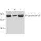 beta Arrestin 1/2 Antibody (21-B1) - Western Blotting - Image 15724 
