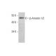 beta Arrestin 1/2 Antibody (21-B1) - Western Blotting - Image 352001