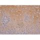 beta Arrestin 1 Antibody (25-G10) - Immunohistochemistry - Image 387075