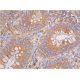 beta Arrestin 1 Antibody (25-G10) - Immunohistochemistry - Image 387076 