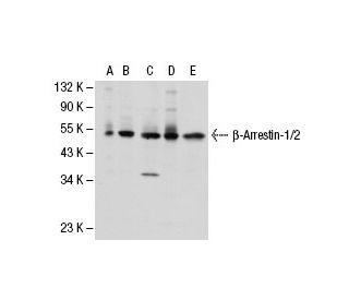 western blotting image from recommended beta Arrestin 1/2 (A-1) monoclonal antibody replacement. Image 30315