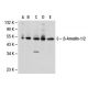 western blotting image from recommended beta Arrestin 1/2 (A-1) monoclonal antibody replacement. Image 30315