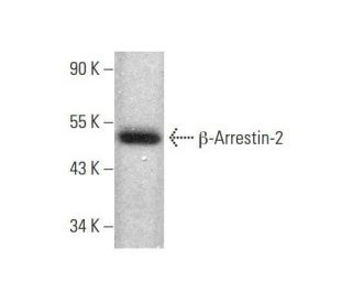 &beta;-Arrestin-2 Antibody (B-4) - Western Blotting - Image 350772 