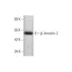 western blotting image from recommended β-Arrestin-2 (B-4) monoclonal antibody replacement. Image 350772
