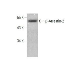 &beta;-Arrestin-2 Antibody (D-3) - Western Blotting - Image 350767 
