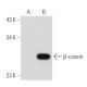 β-casein (H-7): sc-166520. Western blot analysis of β-casein expression in non-transfected: sc-117752 (A) and mouse β-case 