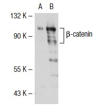beta-catenin Antibody (12F7): sc-59737