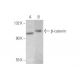 beta-catenin Antibody (A-12) - Western Blotting - Image 350021 