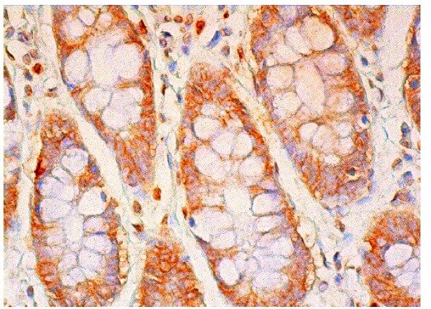 Beta-catenin Antibody (B-9) | SCBT - Santa Cruz Biotechnology