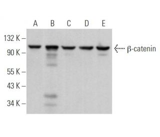 western blotting image from recommended beta-catenin (E-5) monoclonal antibody replacement. Image 362262