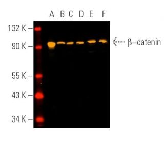beta-catenin Antibody (E-5) - Western Blotting - Image 390712 