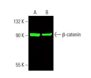 Anti B Catenin Antibody E 5 Scbt Santa Cruz Biotechnology