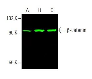 Anti B Catenin Antibody E 5 Scbt Santa Cruz Biotechnology