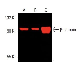 Anti B Catenin Antibody E 5 Scbt Santa Cruz Biotechnology