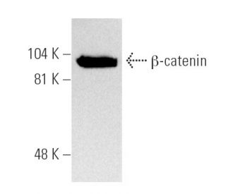 beta-catenin Antibody (E-5) - Western Blotting - Image 5182 
