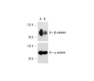 &beta;-catenin siRNA (h): sc-29209. Western blot analysis of &beta;-catenin expression in non-transfected control (A) and 