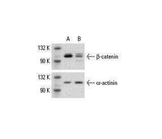 &beta;-catenin siRNA (m): sc-29210. Western blot analysis of &beta;-catenin expression in non-transfected control (A) and 