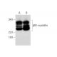 western blotting image from recommended βB1-crystallin (A-8) monoclonal antibody replacement. Image 294259