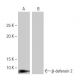 western blotting image from recommended β-defensin 2 (2-RY8) monoclonal antibody replacement. Image 64908