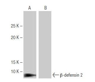 western blotting image from recommended β-defensin 2 (2-RY8) monoclonal antibody replacement. Image 64908