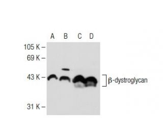 &beta;-dystroglycan Antibody (56) - Western Blotting - Image 109667 