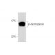 β-dystroglycan Antibody (56) - Western Blotting - Image 138556