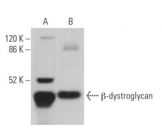 &beta;-dystroglycan Antibody (7D11) - Western Blotting - Image 362935 