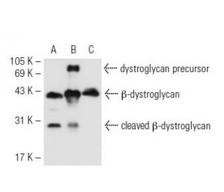 &beta;-dystroglycan Antibody (A-9) - Western Blotting - Image 62319 