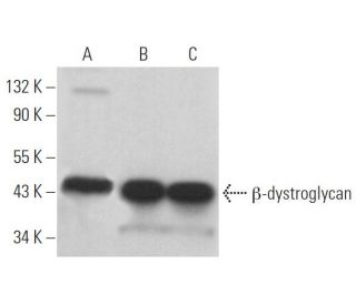 &beta;-dystroglycan Antibody (B-4) - Western Blotting - Image 371489 