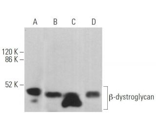 western blotting image from recommended &beta;-dystroglycan (4F7) monoclonal antibody replacement. Image 362936