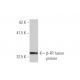 β-FR Antibody (4B12) - Western Blotting - Image 348484