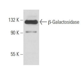 &beta;-Galactosidase Antibody (40-1a) - Western Blotting - Image 16377