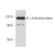 β-Galactosidase Antibody (40-1a) - Western Blotting - Image 16377