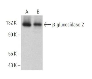 &beta;-glucosidase 2 Antibody (D-10) - Western Blotting - Image 372798 