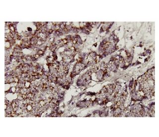 &beta;-glucosidase Antibody (A-16) - Immunohistochemistry - Image 36064 