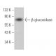 β-glucosidase Antibody (C-2) - Western Blotting - Image 361832