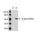 beta-glucosidase (A-16): sc-100544. Western blot analysis of beta-glucosidase expression in... 