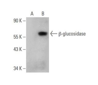 beta-glucosidase (C-2): sc-365745. Western blot analysis of beta-glucosidase expression in... 