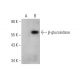 beta-glucosidase (C-2): sc-365745. Western blot analysis of beta-glucosidase expression in... 