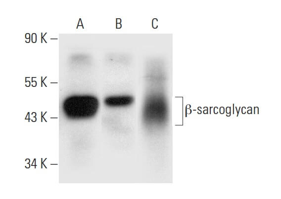 Anti-β-sarcoglycan Antibody (F-6) | SCBT - Santa Cruz Biotechnology