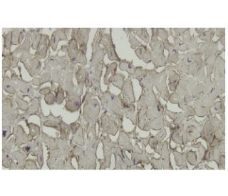 &beta;-sarcoglycan Antibody (RO-17) - Immunohistochemistry - Image 36229 